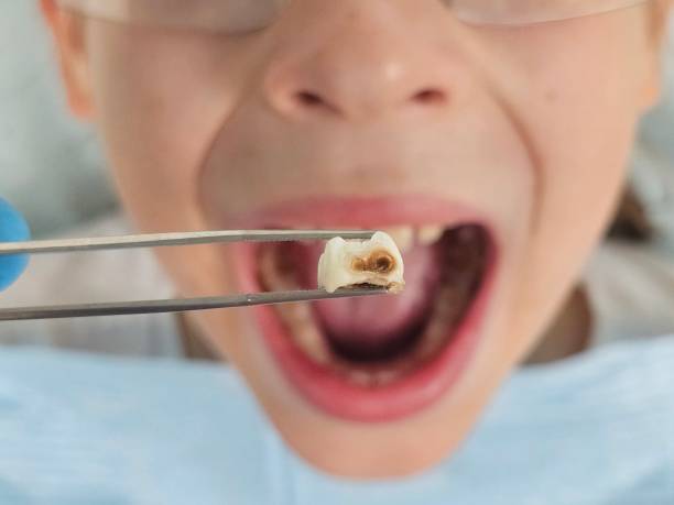 , MS Emergency Dentist Company